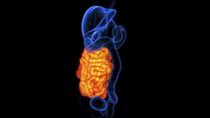 Bowel cancer screening needs a lot of work