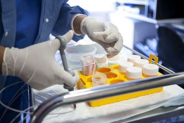 Person dies following bowel screening computer glitch