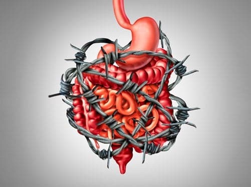 Why bowel cancer is a national emergency